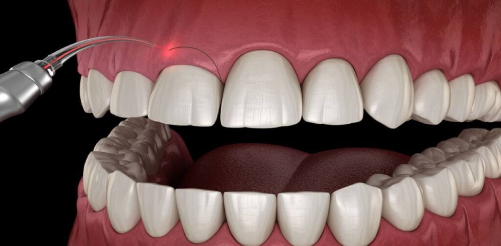 66688cea7aba51fcbcefff3b1c68cda0zuo 813aca